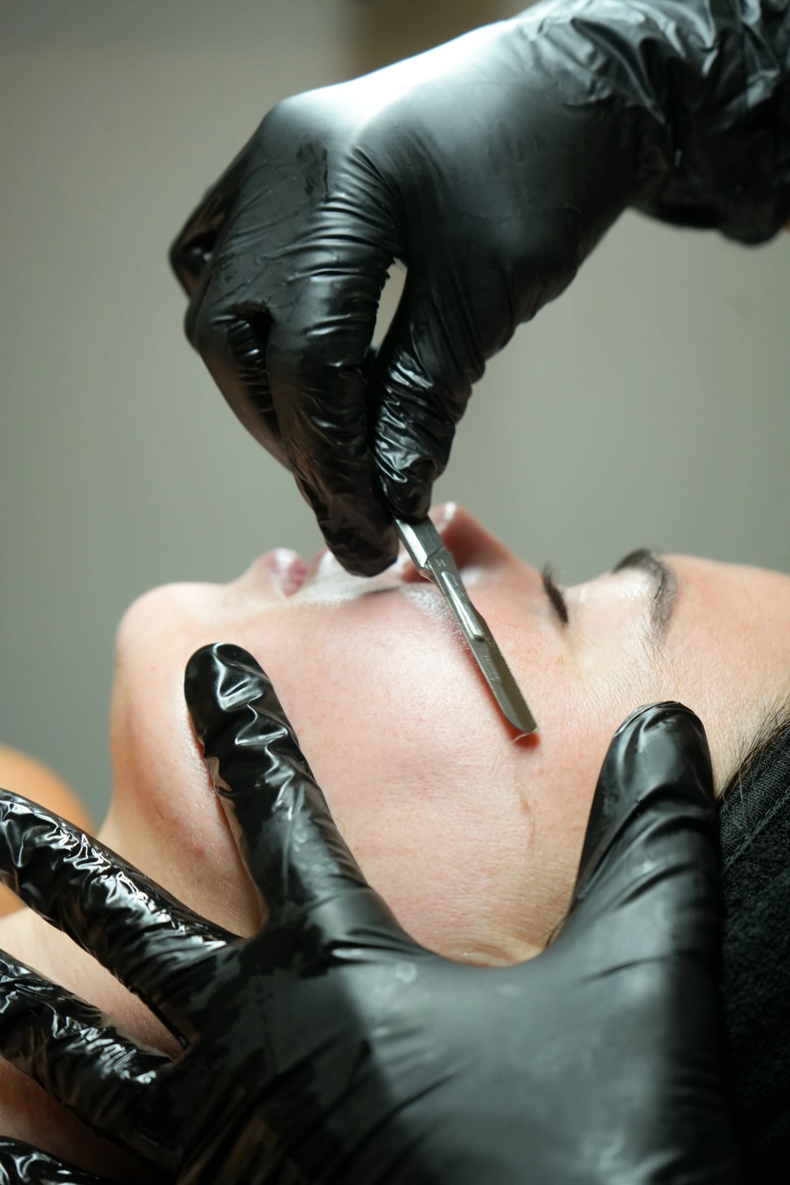Close-up of a dermaplaning facial treatment in a medspa