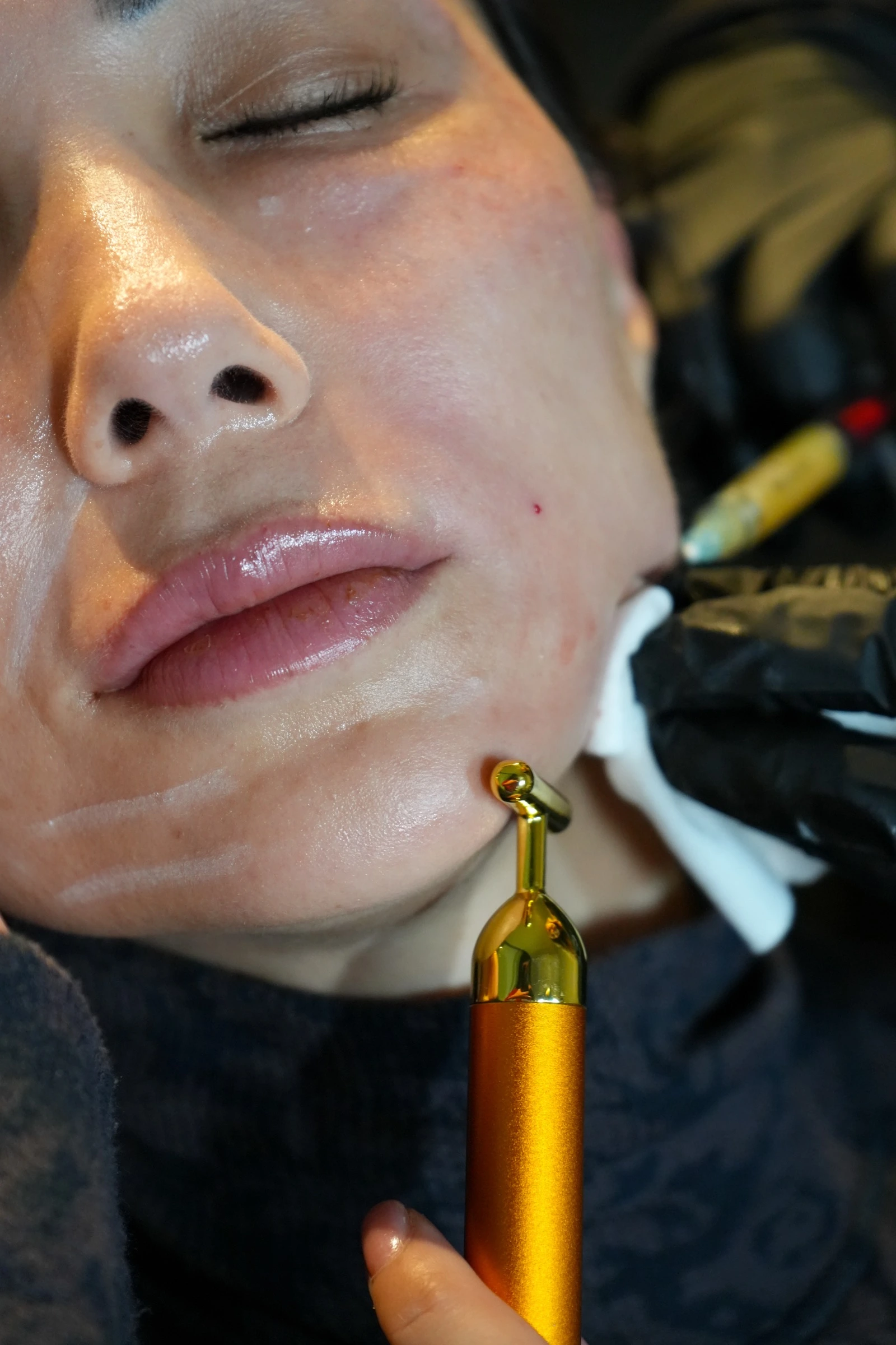Close-up of a medspa facial treatment with a gold massage tool